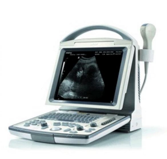 Ultrasonografy mobilne przyłóżkowe MINDRAY DP-20