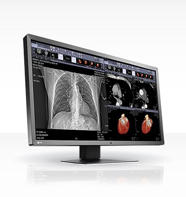 Monitory medyczne Eizo RadiForce MX315W