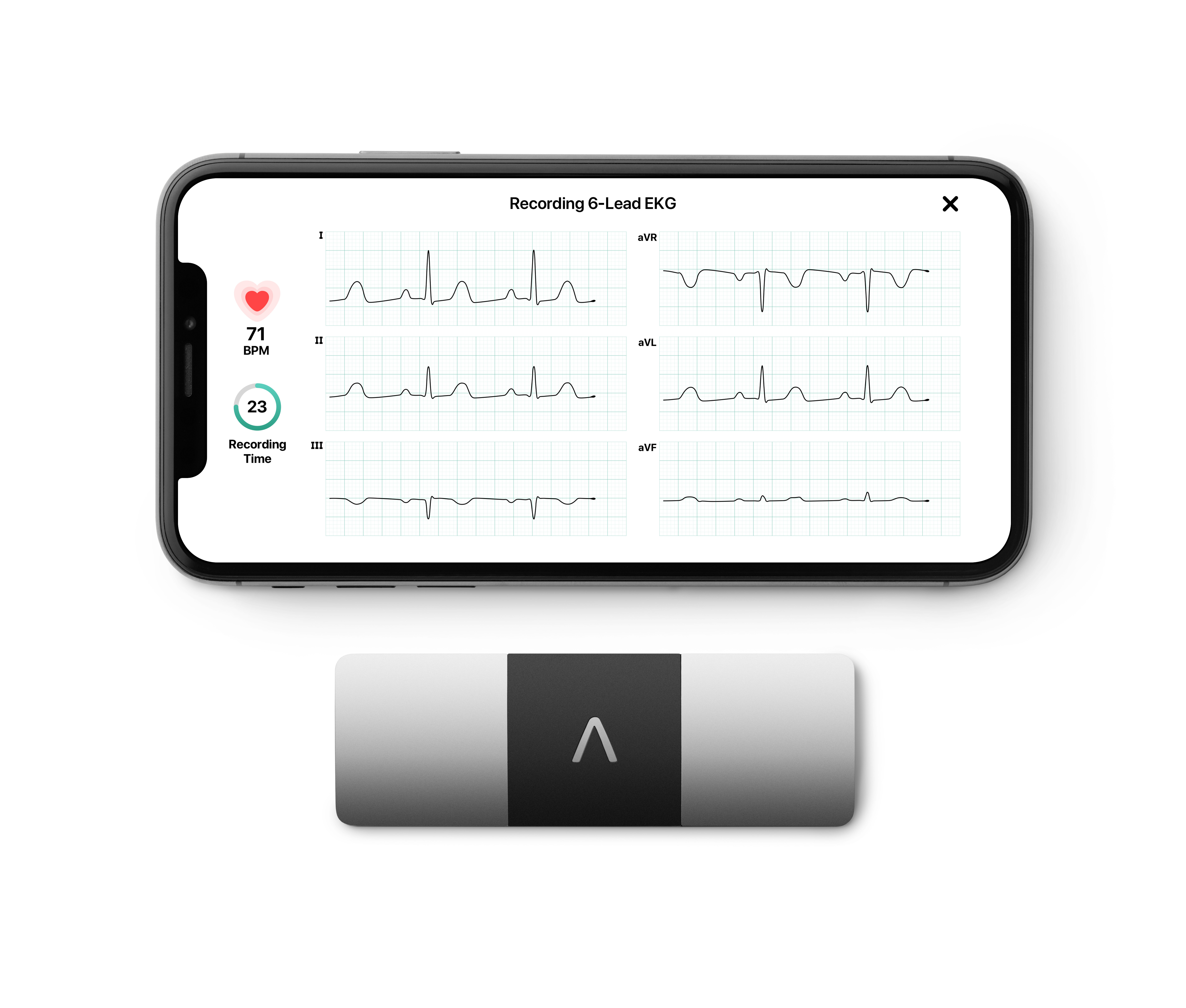 Aparaty EKG ambulatoryjne AliveCor KardiaMobile 6L
