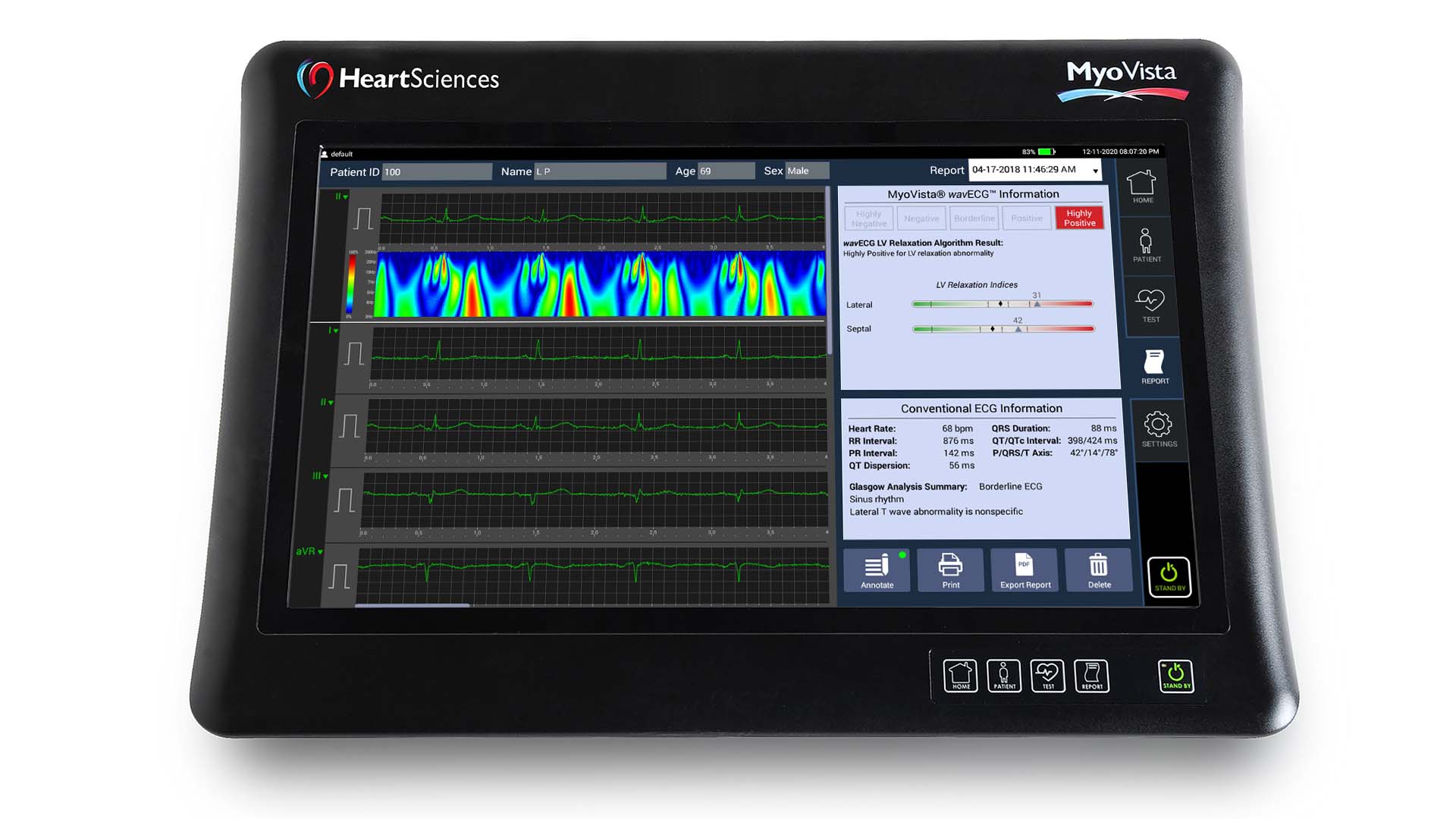 Aparaty EKG - Elektrokardiografy HeartSciences Myovista