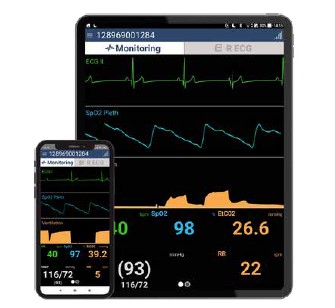 Aplikacje do kopiowania ekranu SCHILLER Do kopiowania