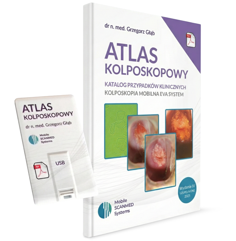 Atlas kolposkopowy katalog przypadków klinicznych