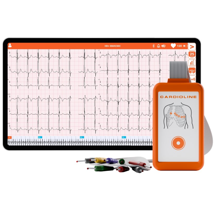 ECG200S