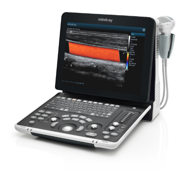 Echokardiografy - UKG MINDRAY Z60