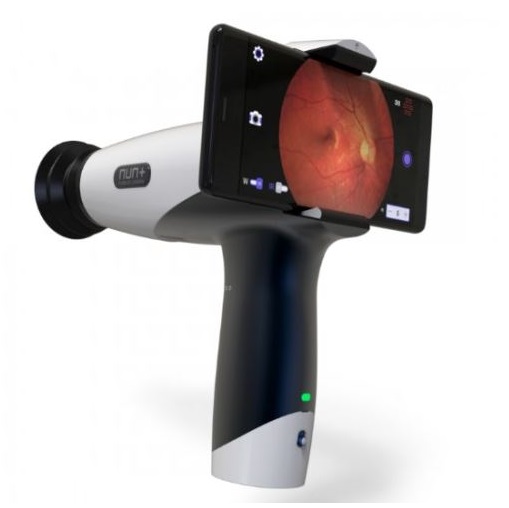Funduskamery WIKIOPTICS NUN+