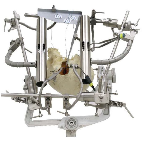 Haki automatyczne - Systemy retraktorów chirurgicznych Mediflex System Davida