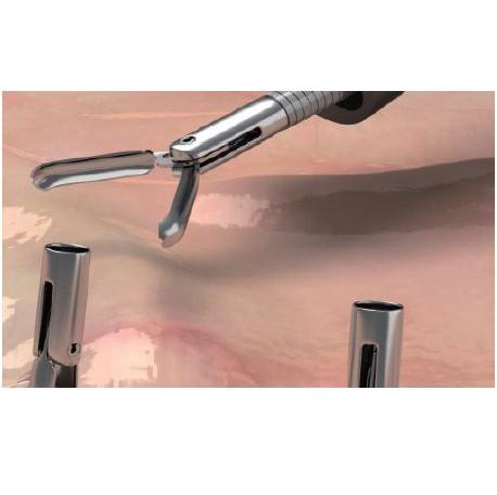 Klipsownice hemostatyczne do endoskopów giętkich MICRO-TECH SureClip Small – LadyClip