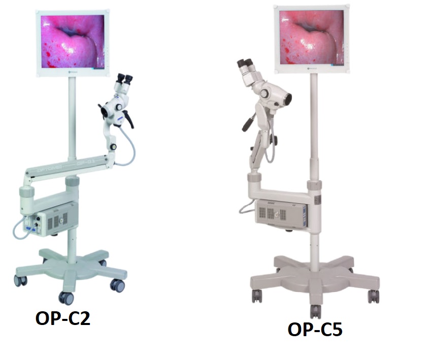 Kolposkopy OPTOMIC OP-C2, OP-C5
