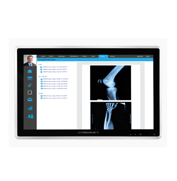 Komputery medyczne All In One CyberMed CM-S22