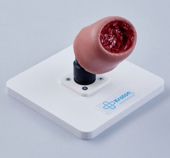 Loża do wyłuszczenia mięśniaka