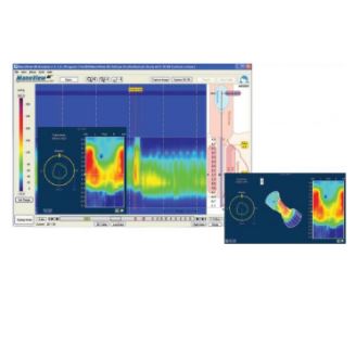 Manometry wysokiej rozdzielczości przewodu pokarmowego Given Imaging 3D anorektalna