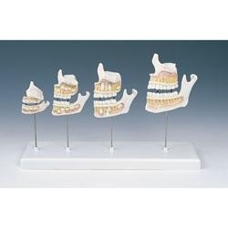 Modele zabiegowe Nasco SB41406U