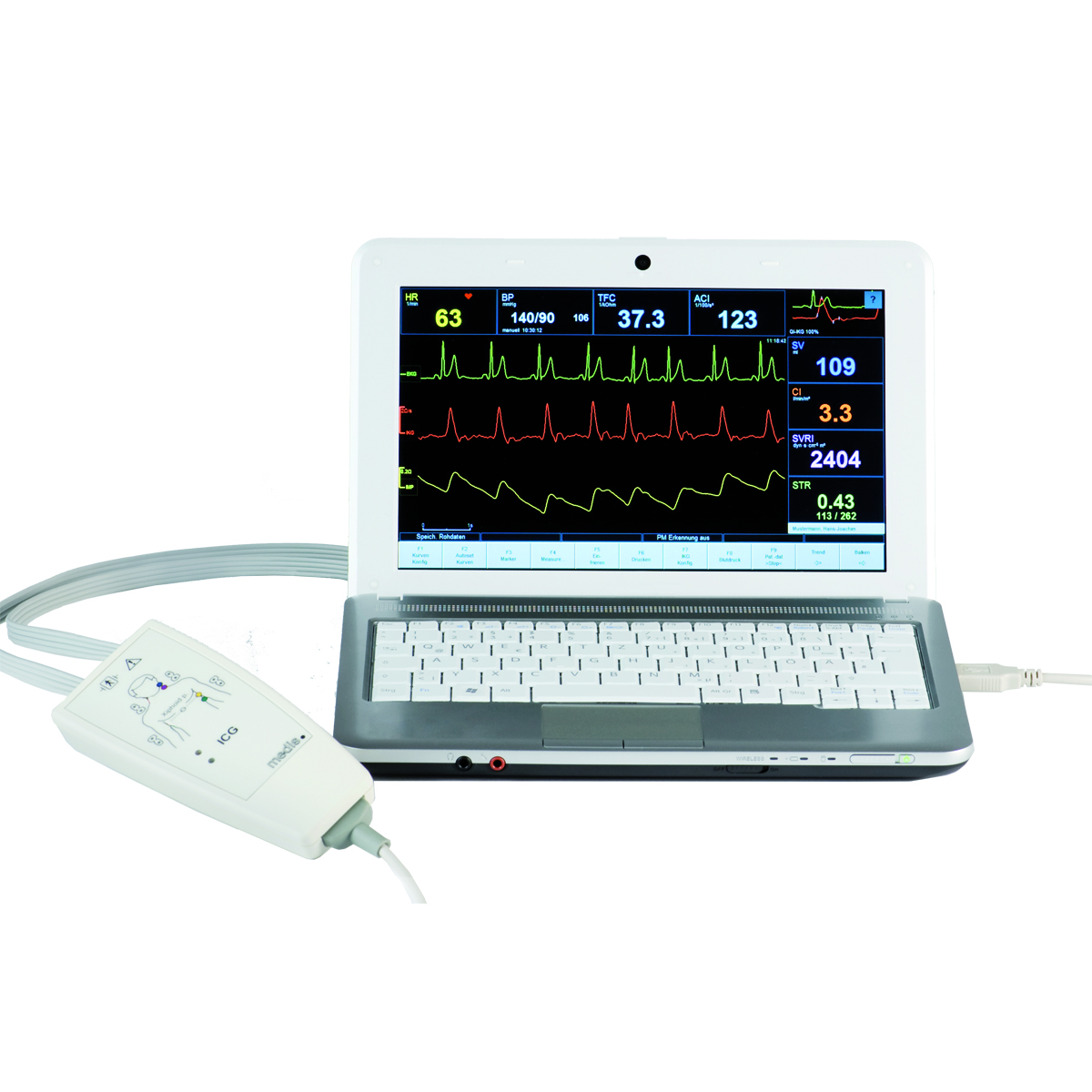 Monitory do pomiarów hemodynamicznych serca i krwi EM-MED CardioScreen 1000
