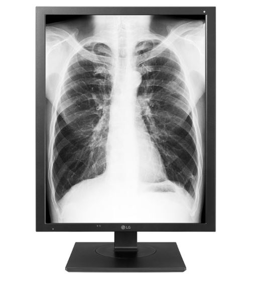 Monitory medyczne LG 21HK512D-B