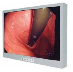 Monitory medyczne REMA 95-00528 HD