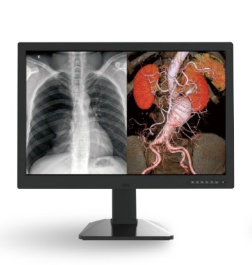 Monitory medyczne Jusha C630G