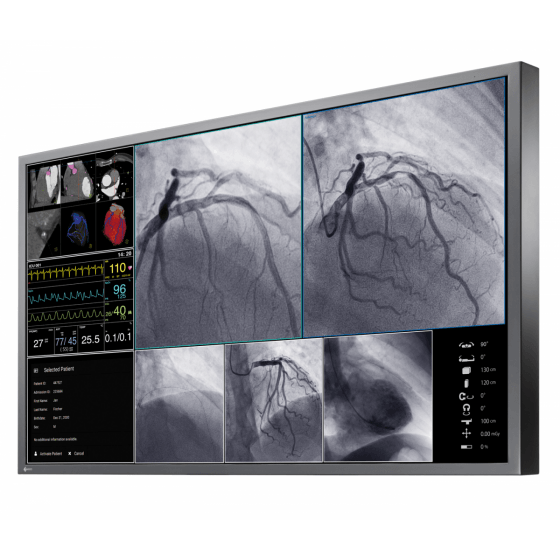 Monitory medyczne Eizo CuratOR LX550W