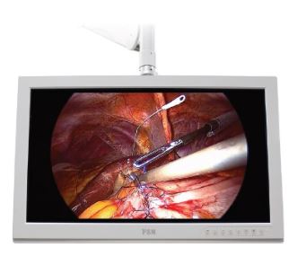 Monitory medyczne FSN FS-P2603D / FS-P2604D