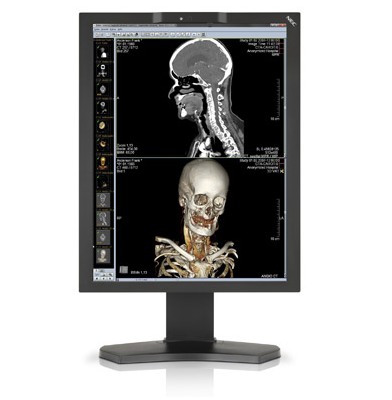 Monitory medyczne NEC MD211C2