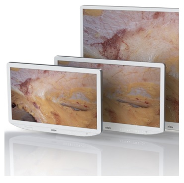 Monitory medyczne XION monitory