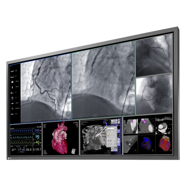 Monitory medyczne Eizo RadiForce LS580W