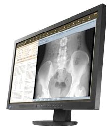 Monitory medyczne Eizo RadiForce MS230W