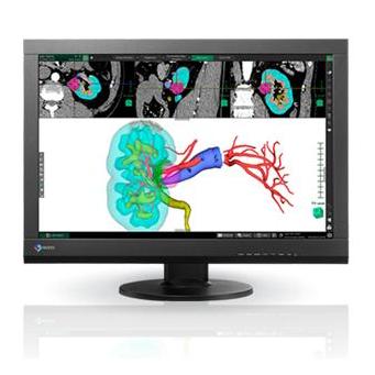 Monitory medyczne Eizo RadiForce MX242W