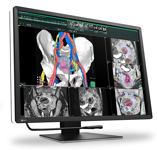 Monitory medyczne Eizo RadiForce RX670