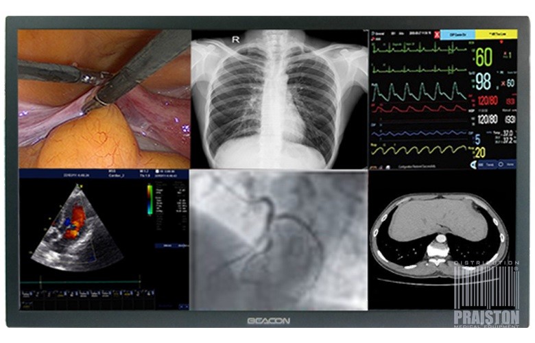 Monitory medyczne BEACON S551