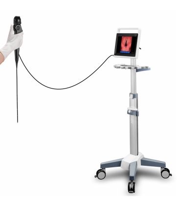 Nasofaryngoskopy (Videonasofaryngoskopy) MDH E30