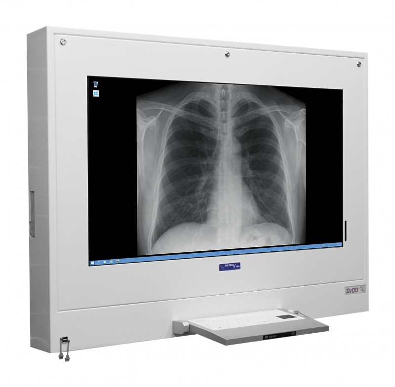 Negatoskopy cyfrowe na salę operacyjną ULTRAVIOL DICO 1M 43" -  NEGATOSKOP RZEGLĄDOWY CYFROWYCH OBRAZÓW MED.