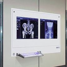 Negatoskopy cyfrowe na salę operacyjną ULTRAVIOL DICO 2M 21"