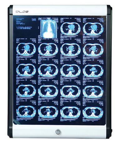 Negatoskopy SLIM LED Jejoong Medical Dilos-100