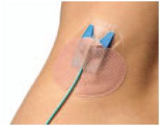 Opatrunki mocujące (cewnik, dren, kaniula) Copenhagen Medlab Drain-Guard