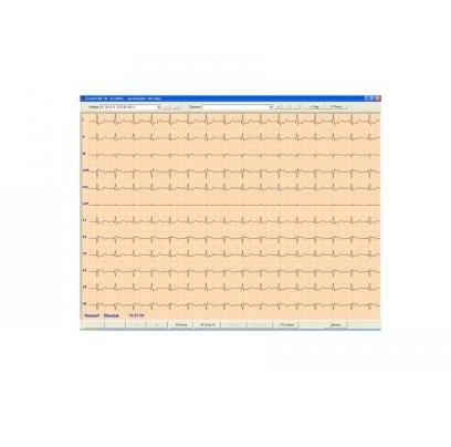Oprogramowanie do Aparatów EKG ASPEL Cardioteka