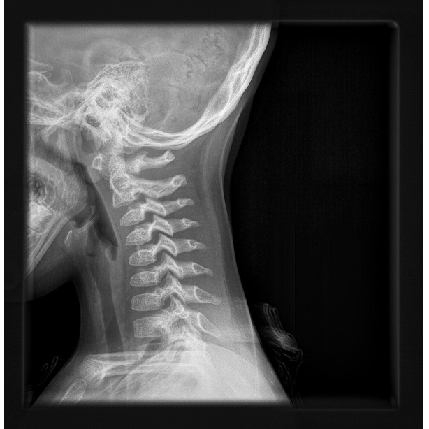 Oprogramowanie radiologiczne AGFA MUSICA
