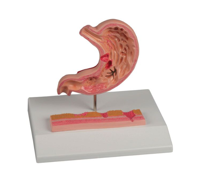 Organy i narządy 3B Scientific K217