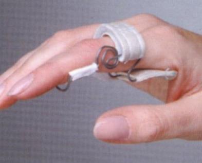 Ortezy i stabilizatory palców Antar H-SIA