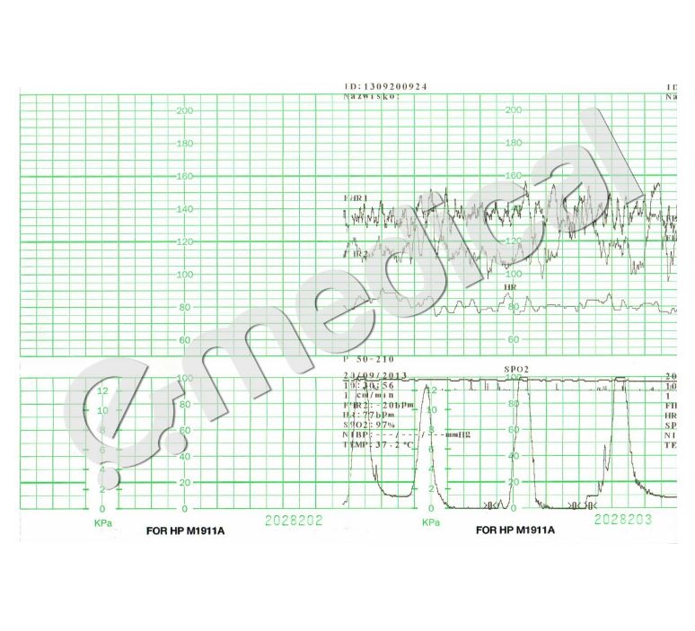 Papiery do KTG – bloki B/D Papier Philips/Edan
