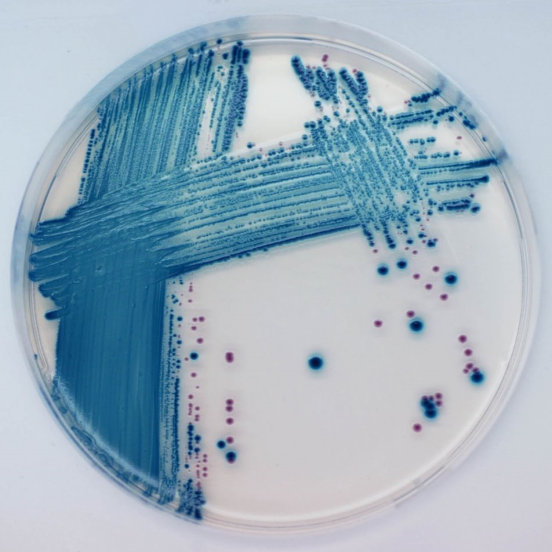 Podłoża gotowe do użycia MAST Diagnostica CHROMagar MAST201470/ MAST201402