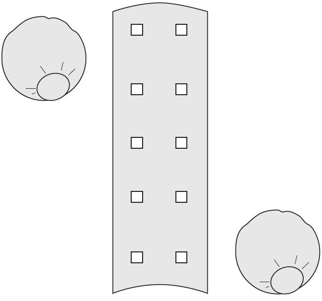 Pokrowce na urządzenia medyczne na salę operacyjną JKT/MOLNLYCKE 380094