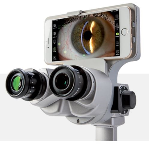 Przystawki cyfrowe do lamp szczelinowych Quantel Medical ION