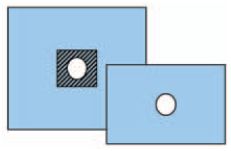 Serwety operacyjne – obłożenie pola operacyjnego ZARYS AT-NFNFA-S