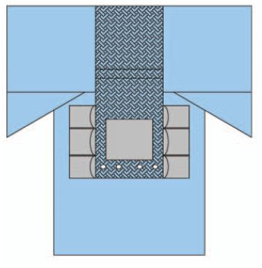Serwety operacyjne – obłożenie pola operacyjnego ZARYS AT-THOR-D