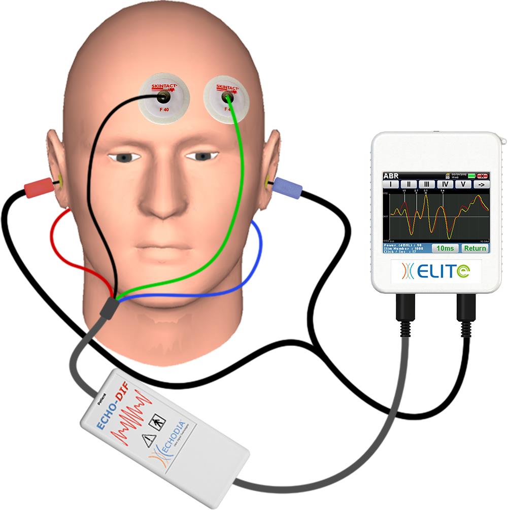 Słuchowe potencjały wywołane ABR/BERA ECHODIA ELITE ABR