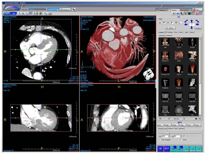 Stacje diagnostyczne obrazów medycznych TeraRecon Aquarius