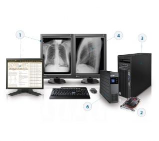 Stacje diagnostyczne obrazów medycznych eMtiM Kompletna stacja RTG