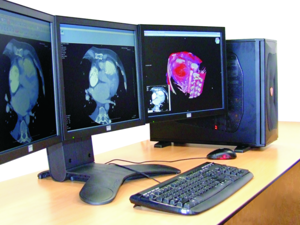 Stacje diagnostyczne obrazów medycznych KIE SPECTO CR/DR