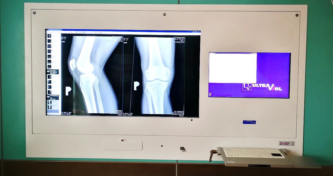 Stacje przeglądowe obrazów medycznych na sale operacyjne ULTRAVIOL DICO 2M 55"/24" STACJA PRZEGLĄDOWA CYFROWYCH OBRAZÓW MEDYCZNYCH