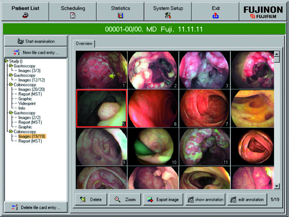 Systemy archiwizacji dla pracowni endoskopowych FUJIFILM - Fujinon Adam